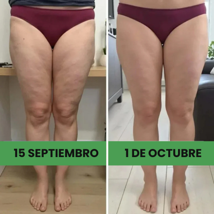 Leggings 3D que moldean y reducen celulitis - [Compra 1 y llévate 2]